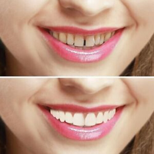smilecorrections.jpg