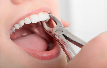 dental-ext.jpg
