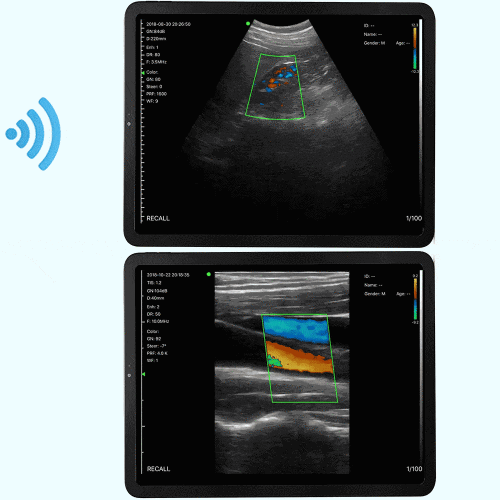 Looking to buy a wireless ultrasound machine? Then you are in right place Sonosif.com gives you the opportunity for purchasing wireless ultrasound machines at a reasonable cost. Investigate our site for more information.

https://www.sonosif.com/