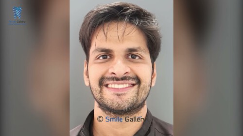 Smile-gallery.com is the highly recommended place for the best orthodontist treatment in bhopal at affordable rates. We help to prevent problems related to jaws and temporomandibular joints. To learn more about us, visit our site.

https://smile-gallery.com/ironthm_service/orthodontic-dental-braces-treatment/