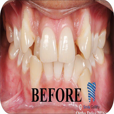 Orthodontics-Before-After-2a-scaled.jpg