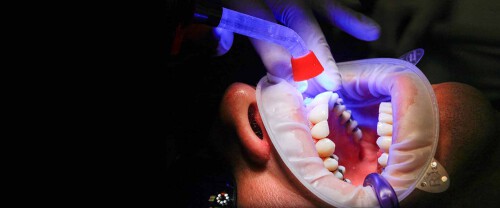 Smile-gallery.com is the highly recommended place for the best orthodontist treatment in bhopal at affordable rates. We help to prevent problems related to jaws and temporomandibular joints. To learn more about us, visit our site.


https://smile-gallery.com/