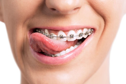 Looking for a smile dental clinic in Bhopal? Smile-gallery.com is one of the best dental clinics with the best braces specialist. Our goal is to provide our patients with the best possible dental care in an environment of comfort and comparison. Please explore our site for more info.

https://smile-gallery.com/