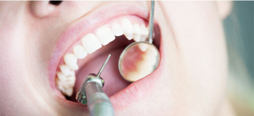 Mittal Dental Clinic is one of the best dental clinics in Jaipur, specializing in Cosmetic Dentistry, Root Canal Treatment, Dental Implants, and Dental Fillings

Read More: https://mittaldentalclinic.com