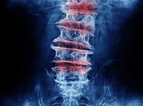 Pune Spine Specialist Dr Shrikant Dalal & Team to guide you in your understanding of Spine Problems, Minimally Invasive Treatment & Surgery.
http://www.punespinecentre.com/