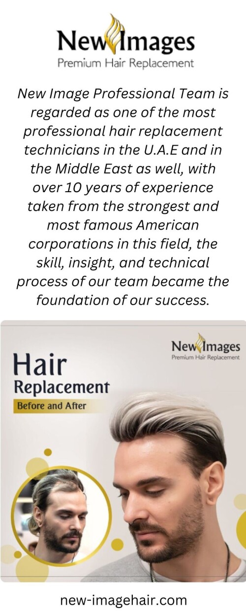New-Image-Professional-Team-is-regarded-as-one-of-the-most-professional-hair-replacement-technicians-in-the-U.A.E-and-in-the-Middle-East-as-well-with-over-10-years-of-experience-taken-from-the-stronge.jpg