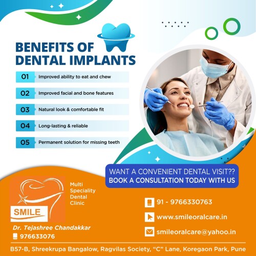 Benefits-of-Dental-Implants.jpg