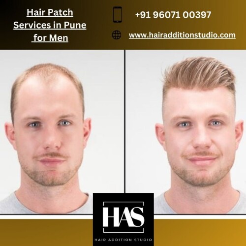 Hair-patch-services-in-Pune-for-men.jpg