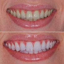 Best-Dentists-In-Turlock-CA.jpg