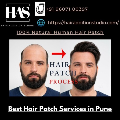 Best Hair Patch Services in Pune (1)