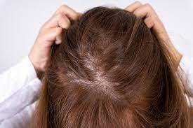 Hair-Loss-Clinic-in-Boston.jpg