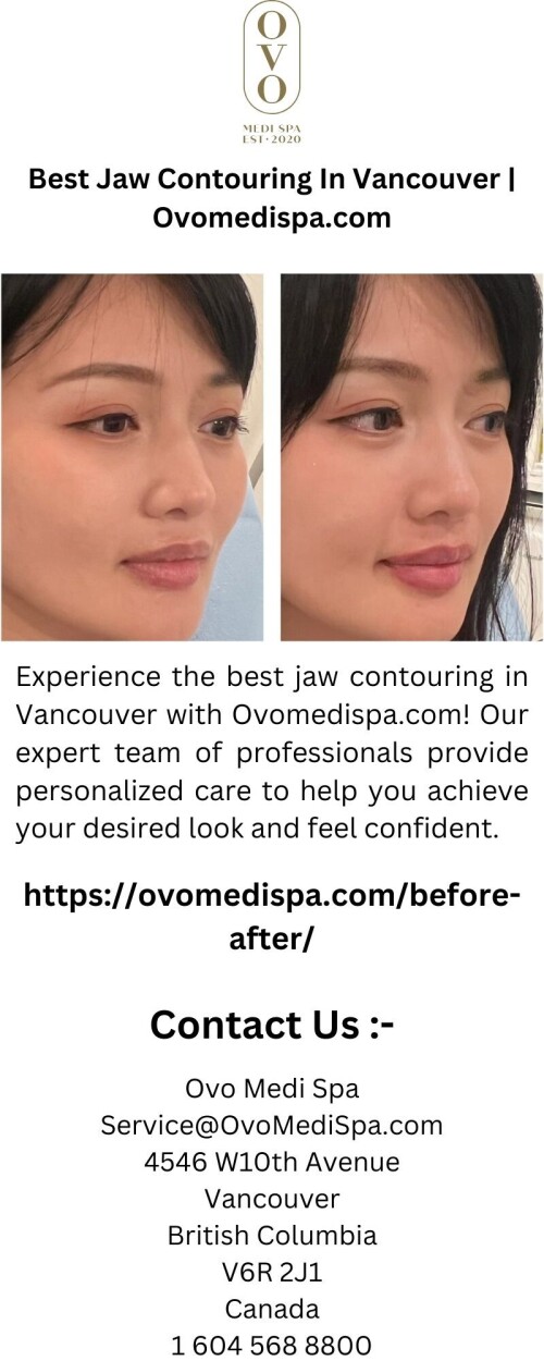 Best-Jaw-Contouring-In-Vancouver-Ovomedispa.com.jpg