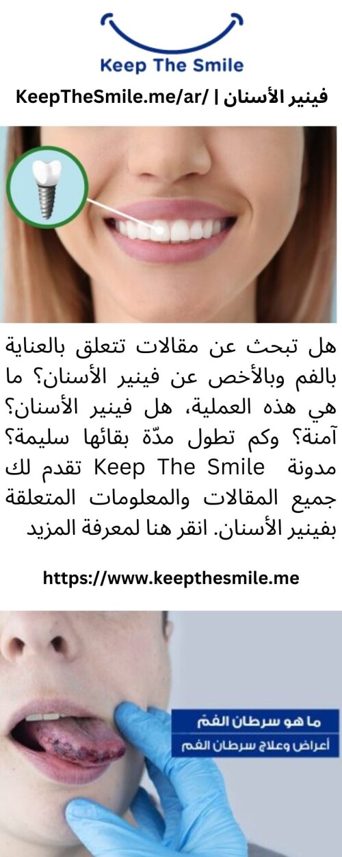 هل تبحث عن مقالات تتعلق بالعناية بالفم وبالأخص عن فينير الأسنان؟ ما هي هذه العملية، هل فينير الأسنان؟ آمنة؟ وكم تطول مدّة بقائها سليمة؟ مدونة  Keep The Smile تقدم لك جميع المقالات والمعلومات المتعلقة بفينير الأسنان. انقر هنا لمعرفة المزيد

https://www.keepthesmile.me/ar/%d8%aa%d8%a8%d9%8a%d9%8a%d8%b6-%d8%a7%d9%84%d8%a3%d8%b3%d9%86%d8%a7%d9%86/%d9%81%d9%8a%d9%86%d9%8a%d8%b1-%d8%a7%d9%84%d8%a3%d8%b3%d9%86%d8%a7%d9%86-%d9%85%d8%a7-%d9%81%d9%88%d8%a7%d8%a6%d8%af-%d9%81%d9%8a%d9%86%d9%8a%d8%b1-%d8%a7%d9%84%d8%a3%d8%b3%d9%86%d8%a7%d9%86/