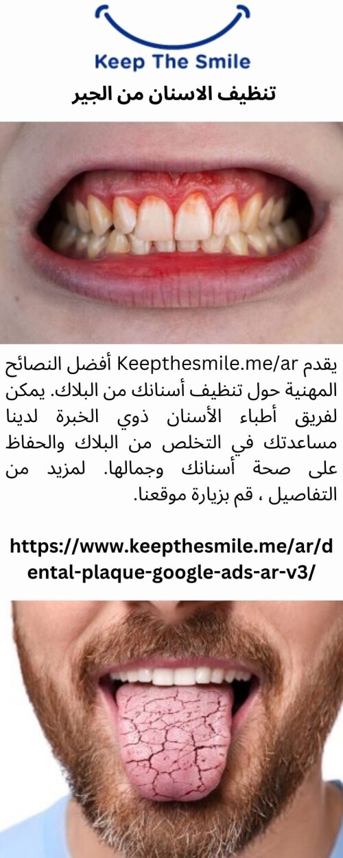 يقدم Keepthesmile.me/ar أفضل النصائح المهنية حول تنظيف أسنانك من البلاك. يمكن لفريق أطباء الأسنان ذوي الخبرة لدينا مساعدتك في التخلص من البلاك والحفاظ على صحة أسنانك وجمالها. لمزيد من التفاصيل ، قم بزيارة موقعنا.


https://www.keepthesmile.me/ar/dental-plaque-google-ads-ar-v3/