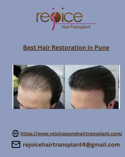 Best-Hair-Restoration-in-Pune.jpg