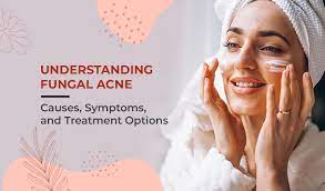 Best-Malassezia-Treatment-Guide.jpg