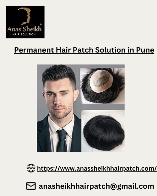 Anas Sheikh Hair Solution Is One Of The Leading Brands in Human
Hair Wigs /Patch In Pune, Mumbai, And Delhi. We Provide High Quality
Hair System Made With 100% Real Human Hair. Hair Patch is a top molded patch made up of normal hair which is utilized to cover baldness. Hair Patch is the best treatment for male baldness. When hair development isn’t conceivable from medications and a man can’t stand to go for hair transplantation. Anas Sheikh gives Best Permanent Hair Patch Solution in Pune
Read More at: https://www.anassheikhhairpatch.com/