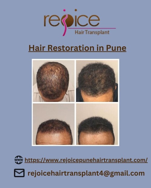 Dr. Shankar Sawant, when he founded Rejoice™ had only one thing in mind.He wanted to provide world-class services of hair transplant in India. And since 2002, we’ve been helping people fight hair loss and baldness.Team Rejoice™ is one of the best hair transplant teams in India.Our experienced doctors led by Dr. Shankar Sawant are experts in their respective domains. They are humble and passionate about serving people. Rejoice gives Best Hair Restoration in Pune
View More at: https://www.rejoicepunehairtransplant.com/