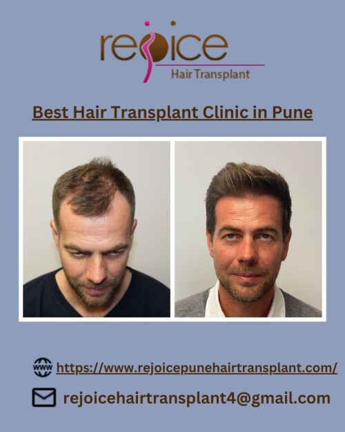Dr. Shankar Sawant, when he founded Rejoice™ had only one thing in mind.He wanted to provide world-class services of hair transplant in India. And since 2002, we’ve been helping people fight hair loss and baldness.Team Rejoice™ is one of the best hair transplant teams in India.Our experienced doctors led by Dr. Shankar Sawant are experts in their respective domains. They are humble and passionate about serving people. Rejoice gives Best Hair Transplant Clinic in Pune
View More at: https://www.rejoicepunehairtransplant.com/