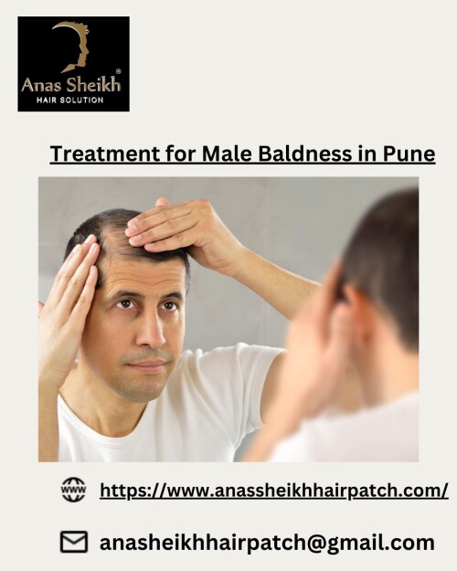 Anas Sheikh Hair Solution Is One Of The Leading Brands in Human
Hair Wigs /Patch In Pune, Mumbai, And Delhi. We Provide High Quality
Hair System Made With 100% Real Human Hair. Hair Patch is a top molded patch made up of normal hair which is utilized to cover baldness. Hair Patch is the best treatment for male baldness. When hair development isn’t conceivable from medications and a man can’t stand to go for hair transplantation. Anas Sheikh gives Best Treatment for Male Baldness in Pune
Read More at: https://www.anassheikhhairpatch.com/