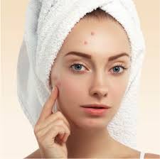 Best-Malassezia-Treatment-Guide.jpg