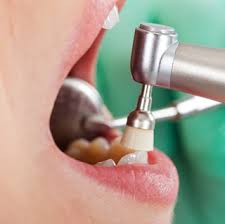 The-Best-Dental-Implants-In-Morton-Grove.jpg