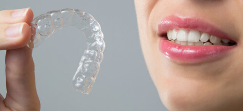 service-invisalign.jpg