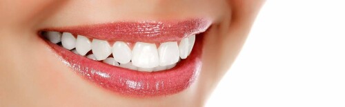 Dental-Bondings.jpg