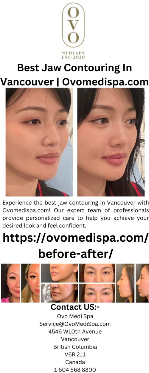 Best-Jaw-Contouring-In-Vancouver-Ovomedispa.com.jpg