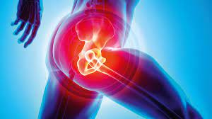 Best-Hip-Replcaement-Surgeon-in-Jaipur.jpg