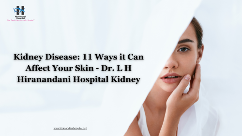 Kidney-Disease-11-Ways-it-Can-Affect-Your-Skin---Dr.-L-H-Hiranandani-Hospital-Kidney.png