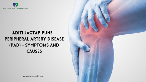 Aditi-Jagtap-Pune-Peripheral-artery-disease-PAD---Symptoms-and-causes.png