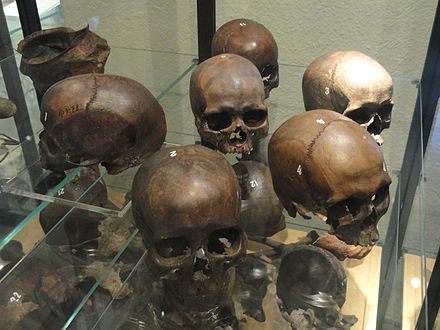 Levaluhta_bog_Merovingian_age_bones_-_National_Museum_of_Finland_-_DSC04176.jpg