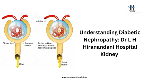 Understanding-Diabetic-Nephropathy-Dr-L-H-Hiranandani-Hospital-Kidney.png