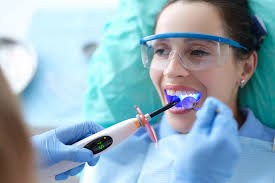 Dental-Bonding-Excellence-in-Chicago-IL.jpg