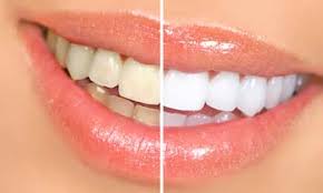 The-Best-Cosmetic-Dentistry-in-Naperville.jpg