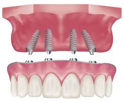 Best-Dentists-in-puyallup-WA.jpg