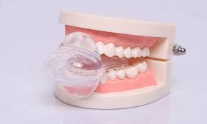 Exploring-Dental-Appliance-Options-for-Sleep-Apnea.jpg