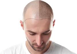 Hair-Loss-Clinic-Boston.jpg