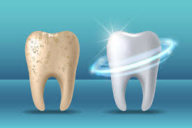 The-Best-Teeth-Whitening-Treatments-in-Turlock-CA.jpg