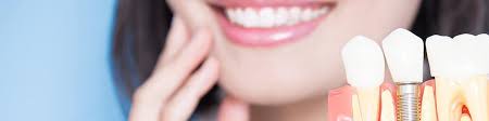 Cosmetic-Dentistry-in-Westlake-Village-CA.jpg