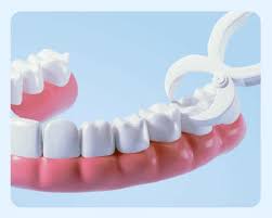 Tooth-Extraction-Lakewood-In-Ranch.jpg