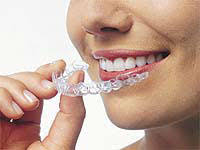 The-Best-Way-to-Get-Invisalign-in-Kennesaw-GA.jpg