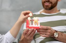 Explore-Dental-Implants-in-Chicago-IL.jpg