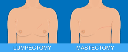 Breast-Cancer-Surgery-Dr.-Melanie-Seah.jpg