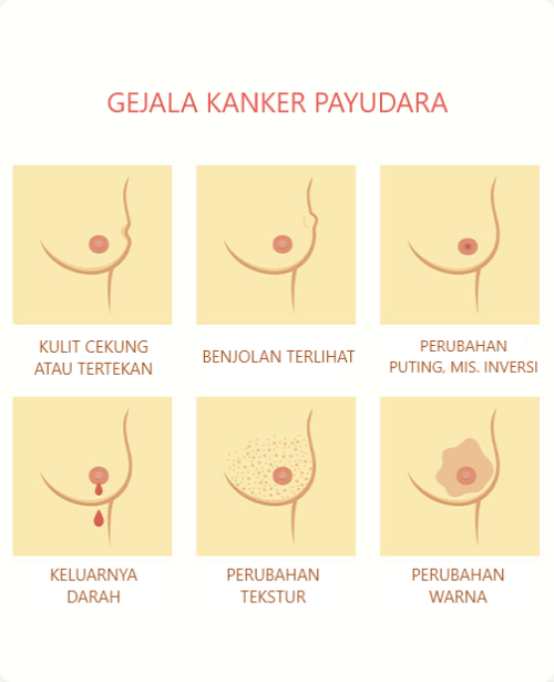 Breast-Lump-Is-It-Cancer-Dr.-Melanie-Seah.png