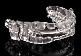 Dental-Appliance-for-Sleep-Apnea-in-New-Orleans.jpg