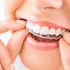 Transform-Your-Smile-with-Invisalign-in-Chicago-IL.jpg