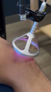 Laser-Therapy.jpg