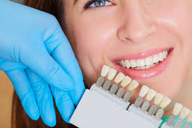 Professional-Teeth-Whitening-in-Edmonton-AB.jpg